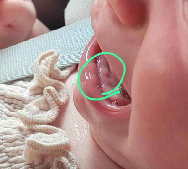 Bild zu Endlich zähne? - Baby Forum - Allgemeine Themen