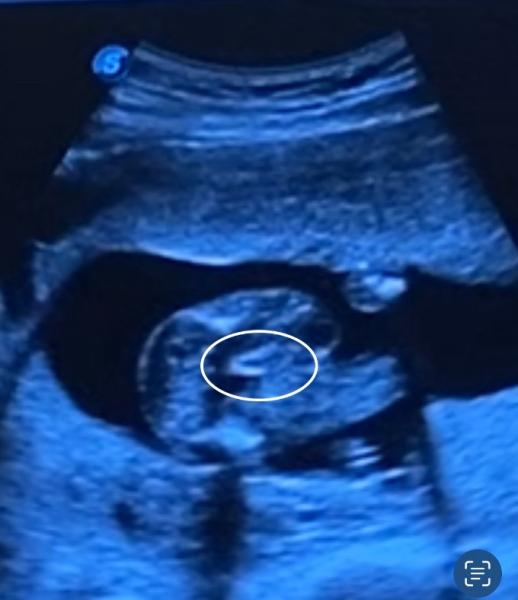 Bild zu MĂ€dchen oder Junge?? đ„° - Baby Forum - Allgemeine Themen