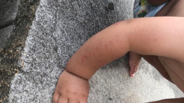 Bild zu Was ist das? - Baby Forum - Allgemeine Themen