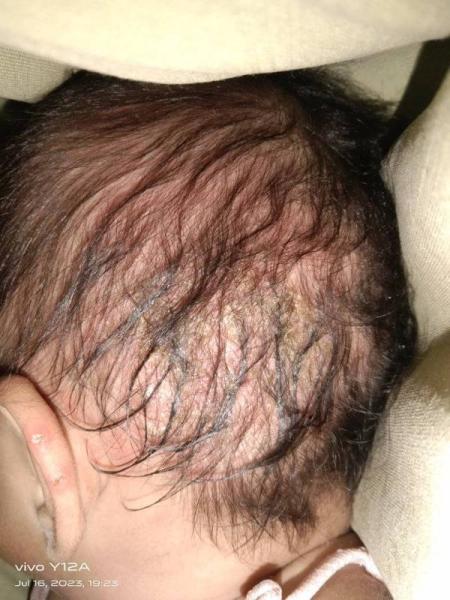 Bild zu Komische Verfärbung am Kopf - Baby Forum - Allgemeine Themen