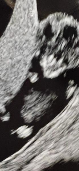 Bild zu Könnt Ihr etwas erkennen ob Mädchen oder junge? - Baby Forum - Allgemeine Themen