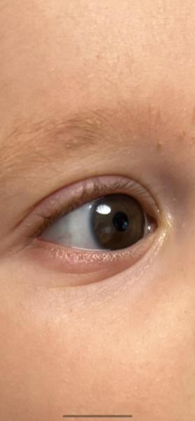 Bild zu Thema Augen - Baby Forum - Allgemeine Themen
