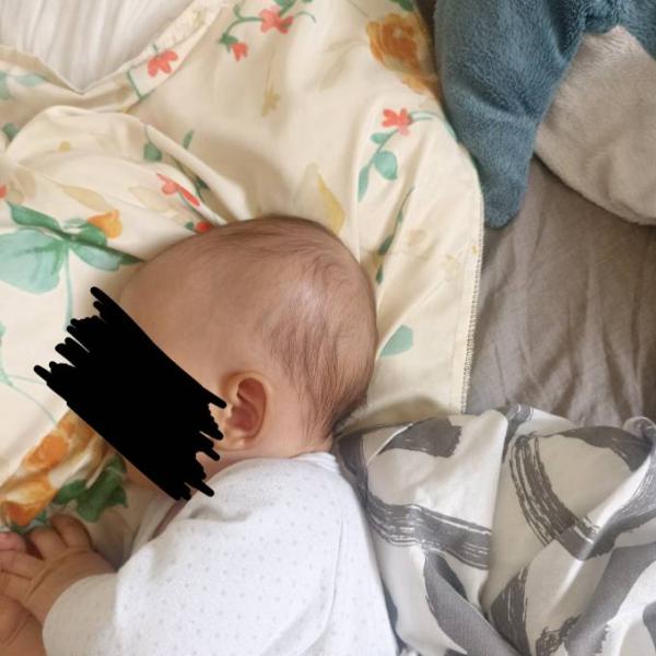 Bild zu Kopfverformung? - Baby Forum - Allgemeine Themen