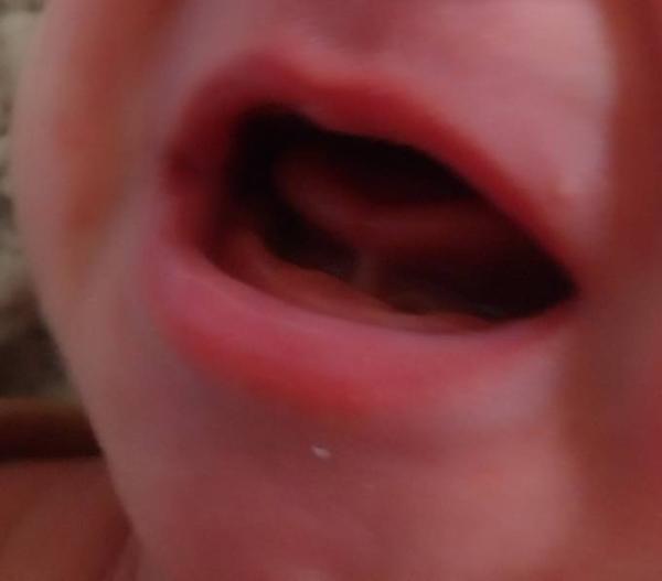Bild zu Kennt sich jemand mit verkürzten Zungenbändchen aus? - Baby Forum - Allgemeine Themen