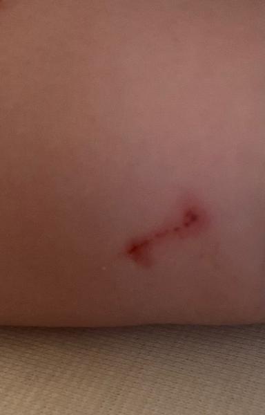 Bild zu Baby 8 Wochen von Katze gekratzt - Baby Forum - Allgemeine Themen