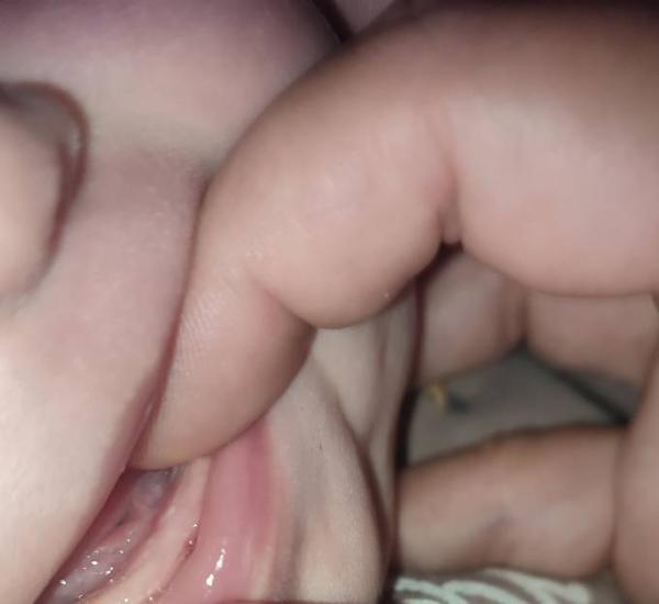 Bild zu Zähne oder doch was anders ? - Baby Forum - Allgemeine Themen
