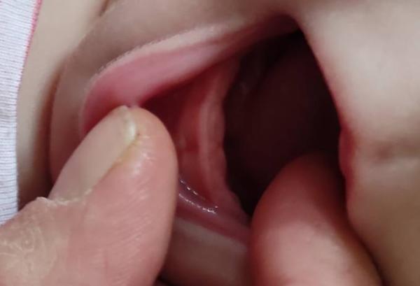 Bild zu Zahnen 4 Monate - Baby Forum - Allgemeine Themen