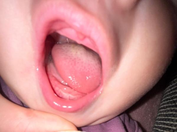 Bild zu 1 zahn - Baby Forum - Allgemeine Themen