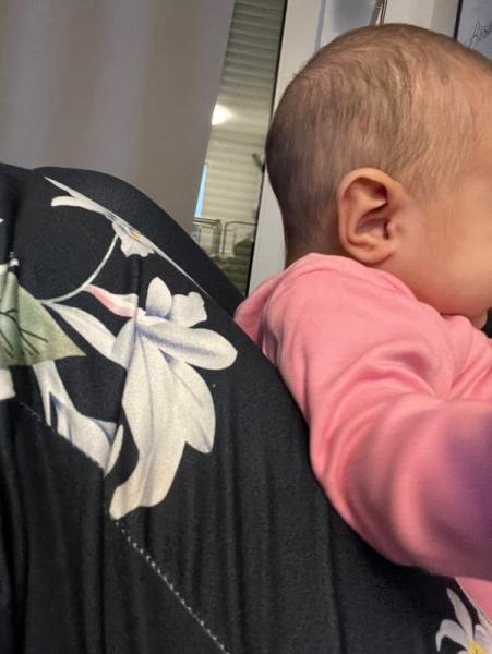 Bild zu Kopf von meiner 5 Monate alten Tochter hängt komisch - Baby Forum - Allgemeine Themen