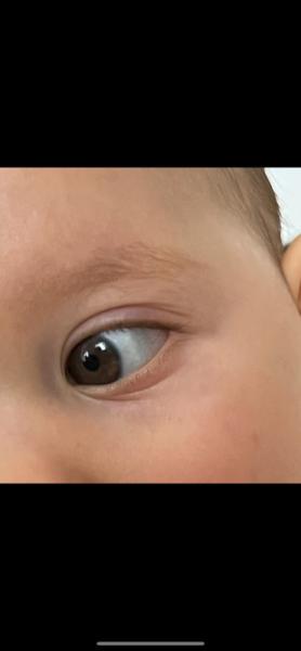 Bild zu Augenweiß wirkt blau - Baby Forum - Allgemeine Themen