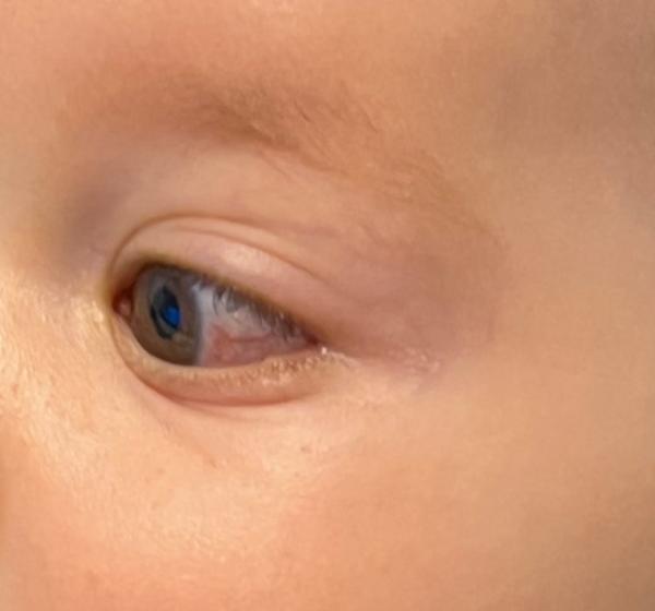 Bild zu Ader im auge rot - Baby Forum - Allgemeine Themen
