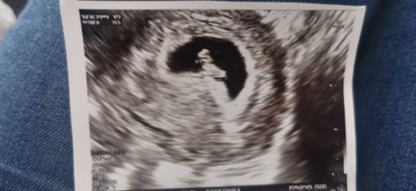 Bild zu Was denkt ihr was es wird... Laut ramzi - Baby Forum - Allgemeine Themen