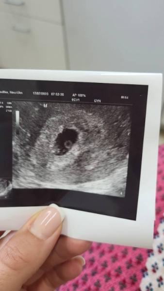 Bild zu Junge oder Mädchen - Baby Forum - Allgemeine Themen