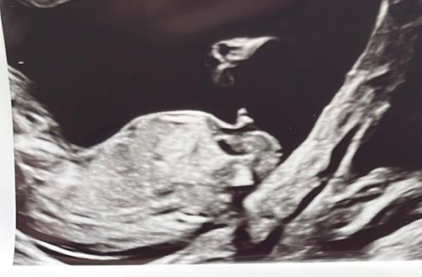 Bild zu Outing - Baby Forum - Allgemeine Themen