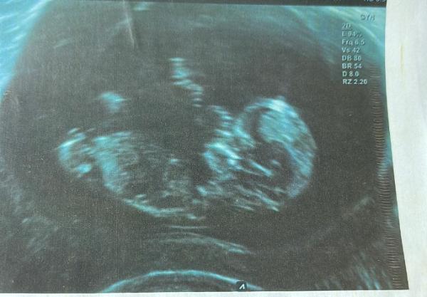 Bild zu Nub Theorie - Baby Forum - Allgemeine Themen