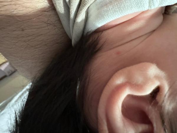 Bild zu Baby 2 Monate, rote kleine punkte im gesicht - Baby Forum - Allgemeine Themen
