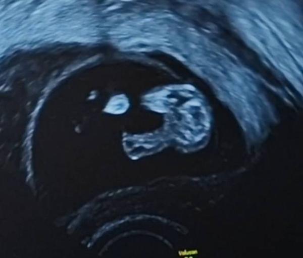 Bild zu Mädchen oder Junge was denkt ihr - Baby Forum - Allgemeine Themen