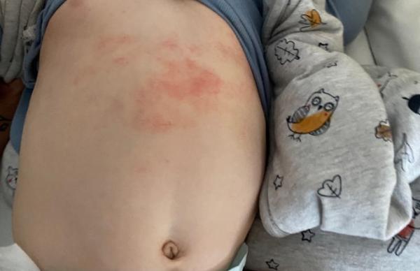 Bild zu Was könnte das sein - Baby Forum - Allgemeine Themen