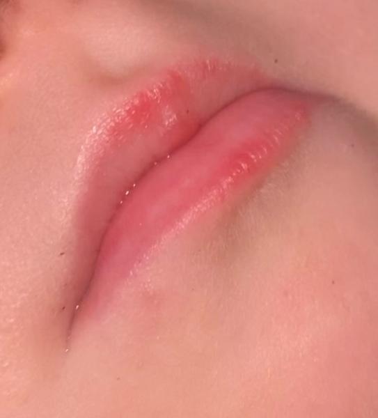 Bild zu Rote lippen was hilft ? - Baby Forum - Allgemeine Themen