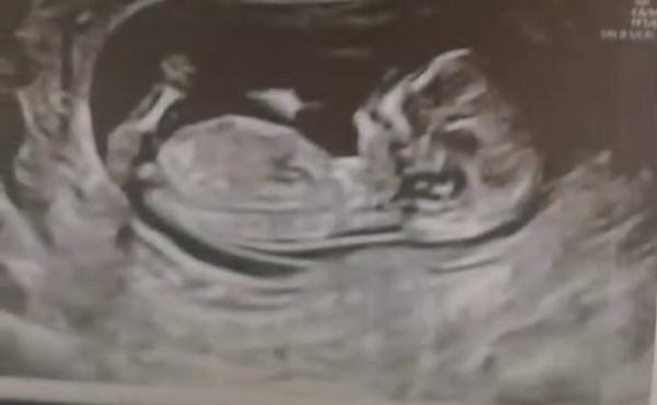 Bild zu SUCHE NACH NUB SPEZIALISTINNEN - Baby Forum - Allgemeine Themen