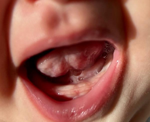 Bild zu Zahnen mit 17 Wochen? - Baby Forum - Allgemeine Themen