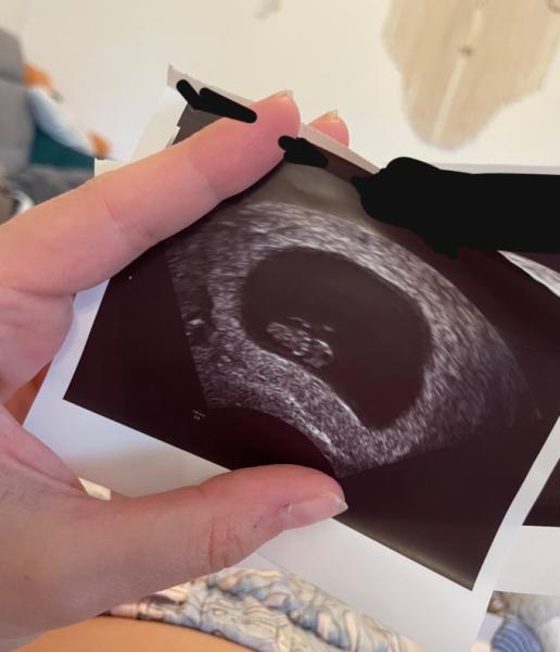 Bild zu Baby Geschlecht - Baby Forum - Allgemeine Themen