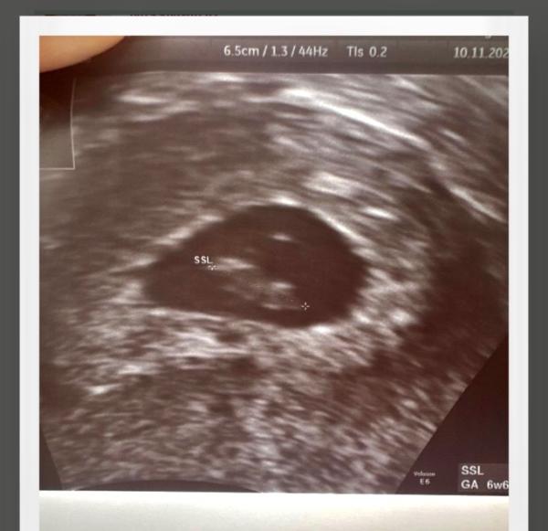 Bild zu Ramzi - wer kennt sich aus? - Baby Forum - Allgemeine Themen