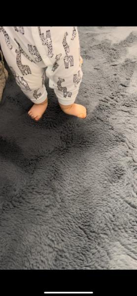 Bild zu Dreht sein fuß nach außen - Baby Forum - Allgemeine Themen