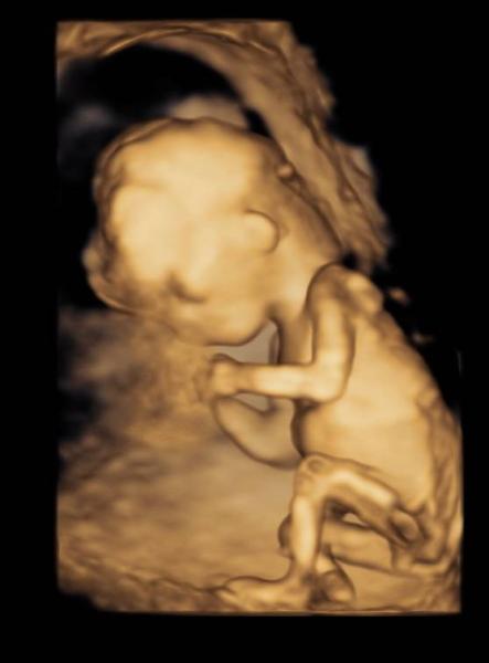 Bild zu Nub Theorie - Baby Forum - Allgemeine Themen