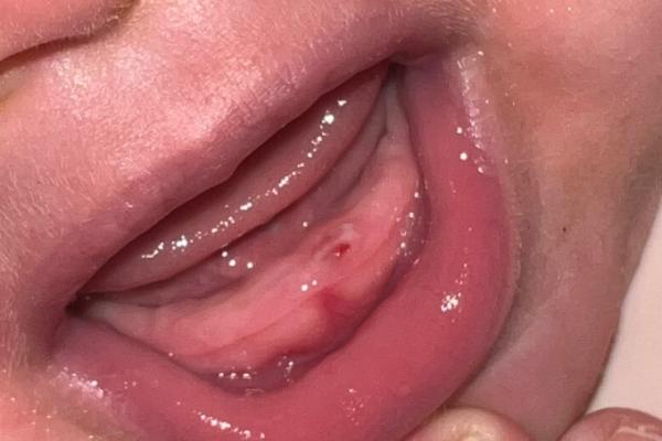 Bild zu Zahnfleisch blutig - Baby Forum - Allgemeine Themen