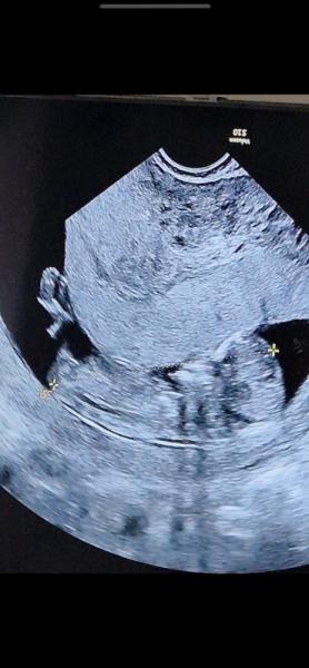 Bild zu Nub Theorie - Baby Forum - Allgemeine Themen