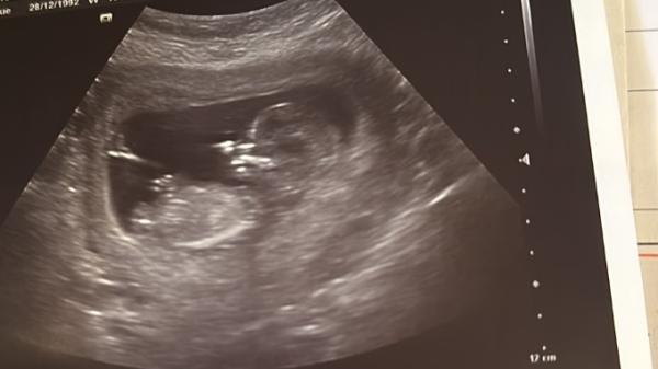 Bild zu Mädchen oder Junge - Baby Forum - Allgemeine Themen