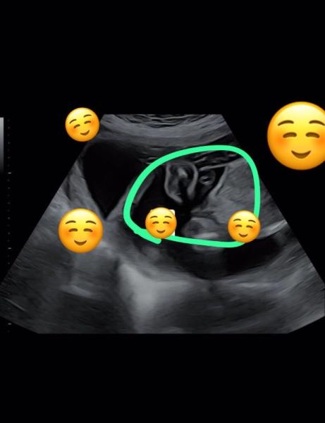 Bild zu Mädchen Outing - Baby Forum - Allgemeine Themen