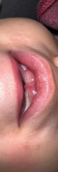 Bild zu Was ist das am Zahnfleisch? - Baby Forum - Allgemeine Themen