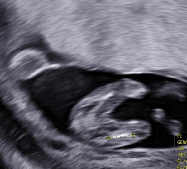 Bild zu Kann jemand das Geschlecht erkennen? - Baby Forum - Allgemeine Themen
