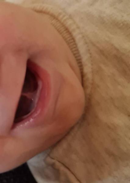 Bild zu Zungenbändchen - Baby Forum - Allgemeine Themen