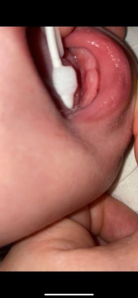 Bild zu Kommen da Zähne ? - Baby Forum - Allgemeine Themen