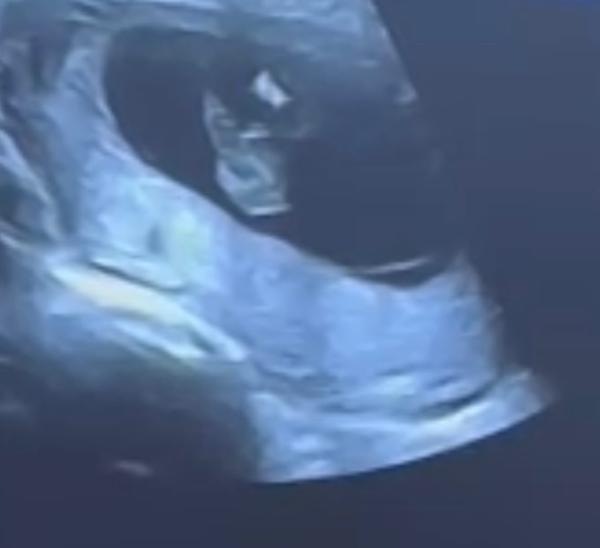 Bild zu Was glaubt ihr welches Geschlecht?☺️ - Baby Forum - Allgemeine Themen