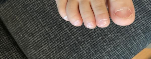 Bild zu Fußnägel von meinem Sohn - Baby Forum - Allgemeine Themen