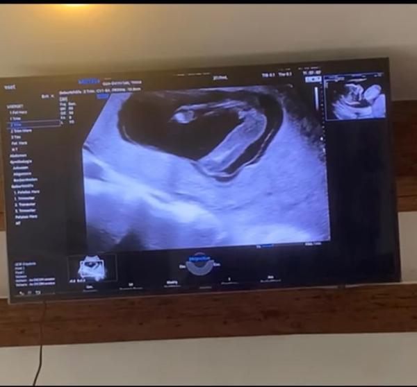 Bild zu Mädchen oder doch junge ? - Baby Forum - Allgemeine Themen