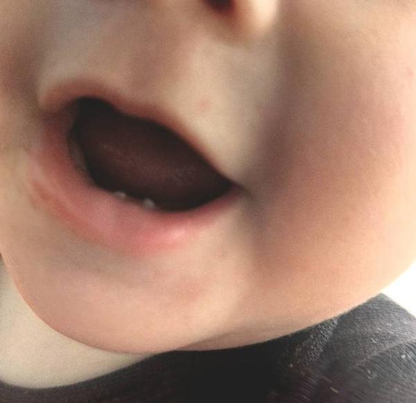 Bild zu Milchzähne sehen komisch aus - Baby Forum - Allgemeine Themen