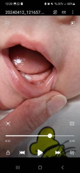 Bild zu Zahnen - Baby Forum - Allgemeine Themen