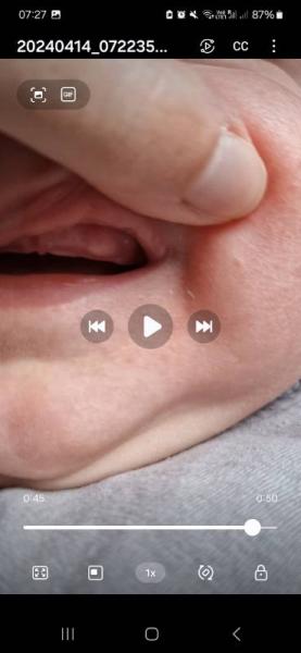Bild zu Zahnen - Baby Forum - Allgemeine Themen