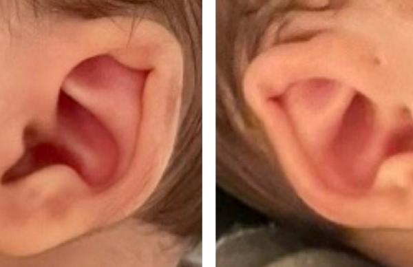 Bild zu Ohren - Baby Forum - Allgemeine Themen