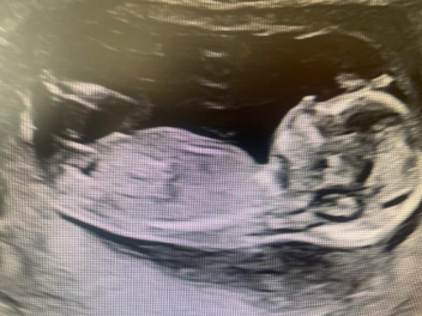 Bild zu Mädchen oder Junge? - Baby Forum - Allgemeine Themen