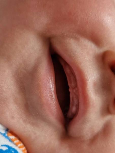 Bild zu Zahnen - Baby Forum - Allgemeine Themen