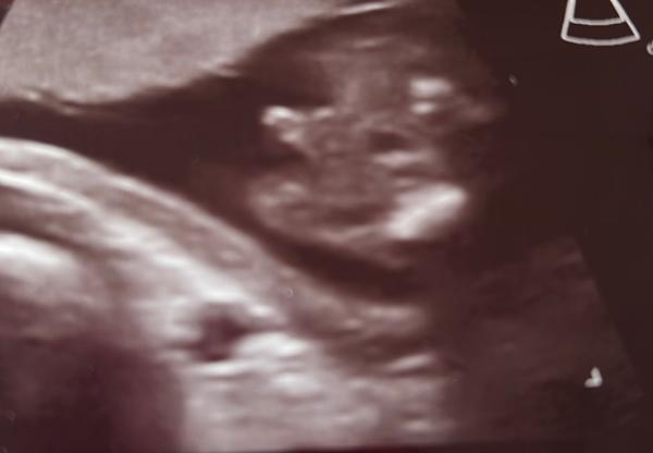 Bild zu Geschlecht von zweiten Baby hat sich geändert.. - Baby Forum - Allgemeine Themen