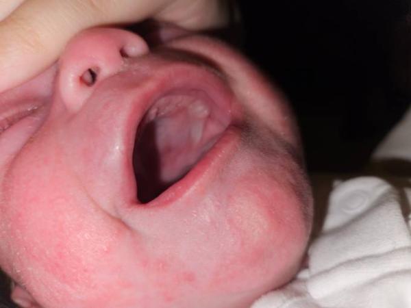 Bild zu Epsteinperle oder Zahn - Baby Forum - Allgemeine Themen