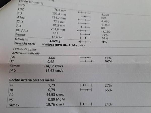 Bild zu Baby zu leicht und Beckenendlage - Baby Forum - Allgemeine Themen