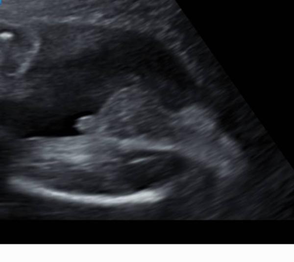 Bild zu Geschlecht - Baby Forum - Allgemeine Themen